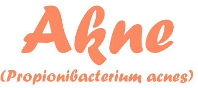 Akne